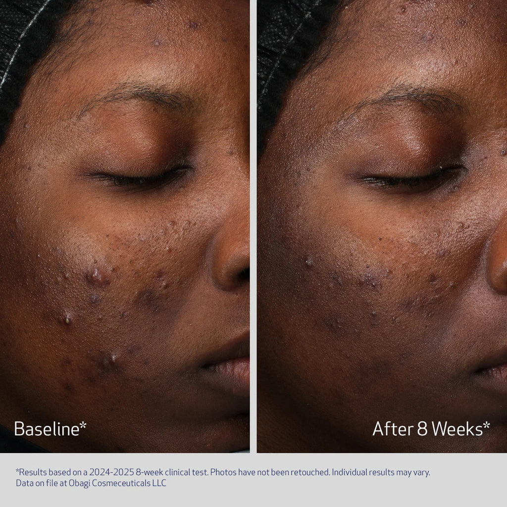 Obagi Retinol + PHA Refining Night Cream
