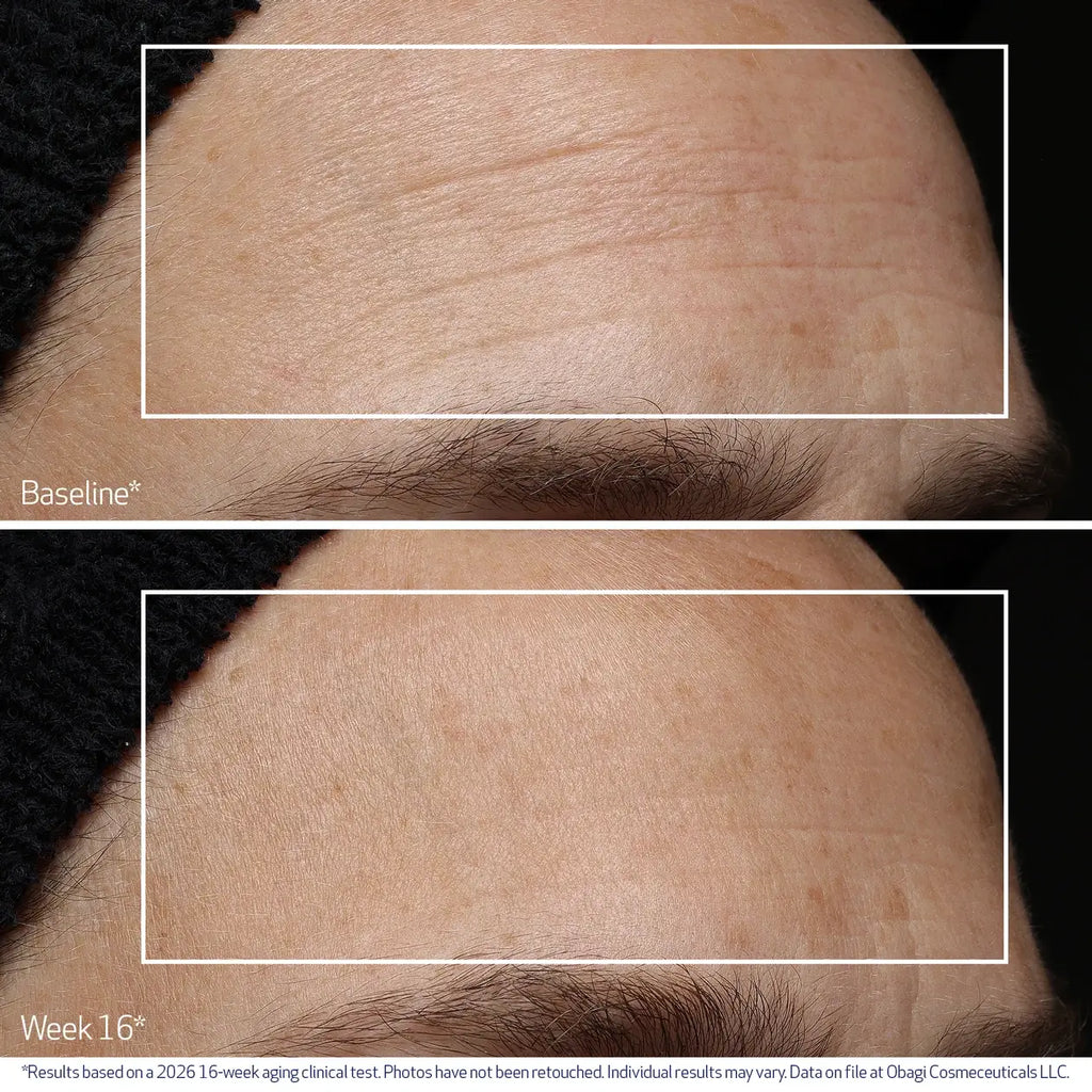 Obagi Professional-C Serum 20% Vitamin C