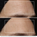 Obagi Professional-C Serum 20% Vitamin C
