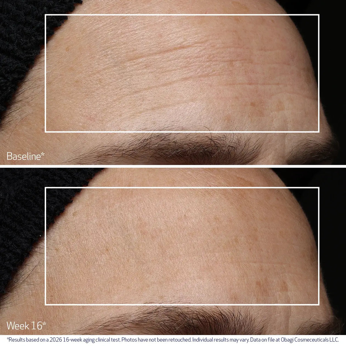 Obagi Professional-C Serum 20% Vitamin C